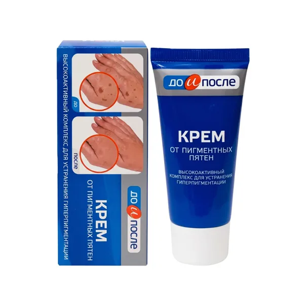 Kem Giảm Đồi Mồi Da Tay Kpem Từ Nga 50ml