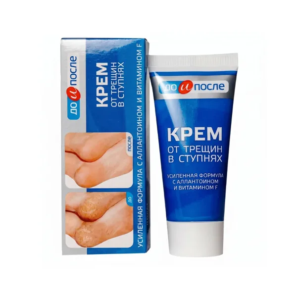 Kem Giảm Nứt Gót Chân Kpem Của Nga 50ml